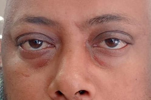 Plastic surgery for men
